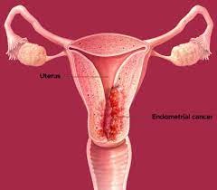 Endometrium Nedir?